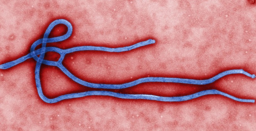 Wirus Ebola to jeden z najbardziej zabójczych zarazków na Ziemi /AFP