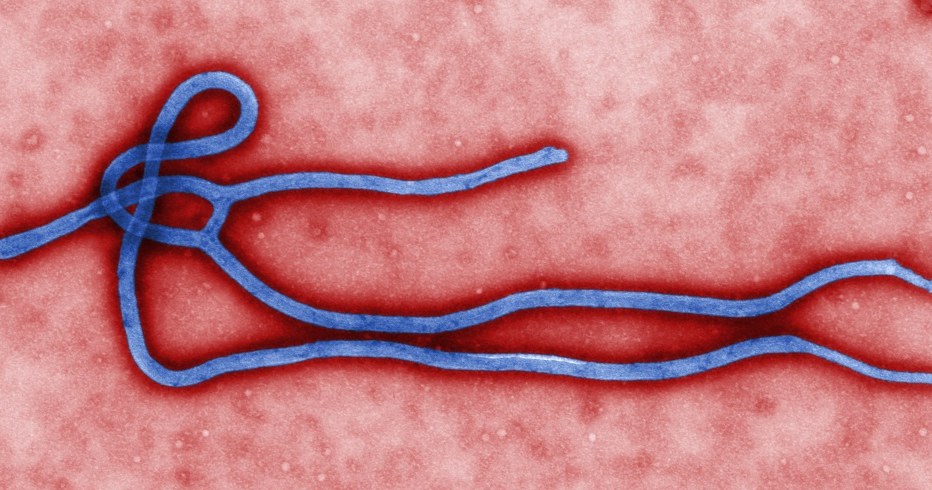 Wirus Ebola to jeden z najbardziej zabójczych zarazków na Ziemi /AFP