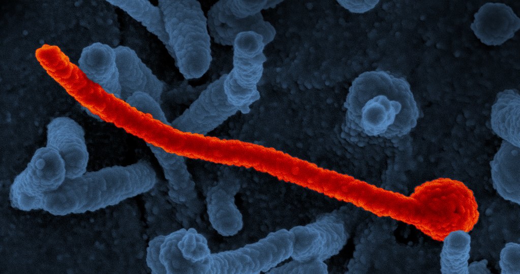 Wirus Ebola /materiały prasowe