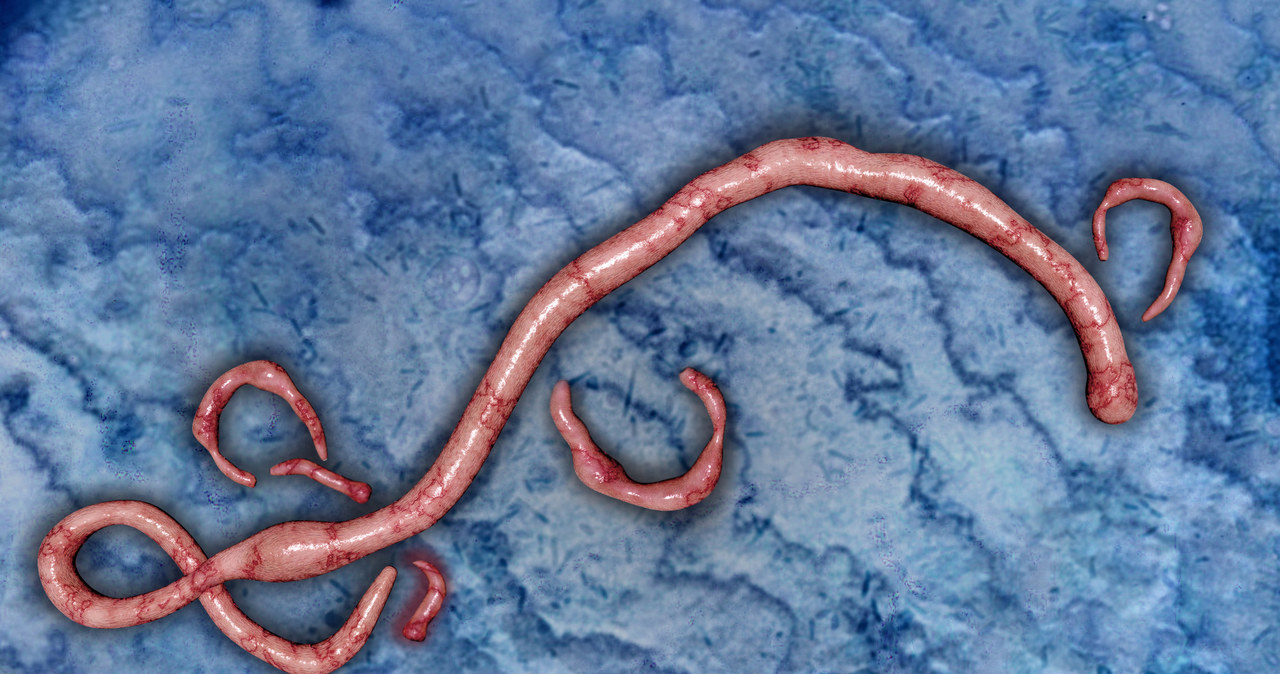 Wirus Ebola /123RF/PICSEL