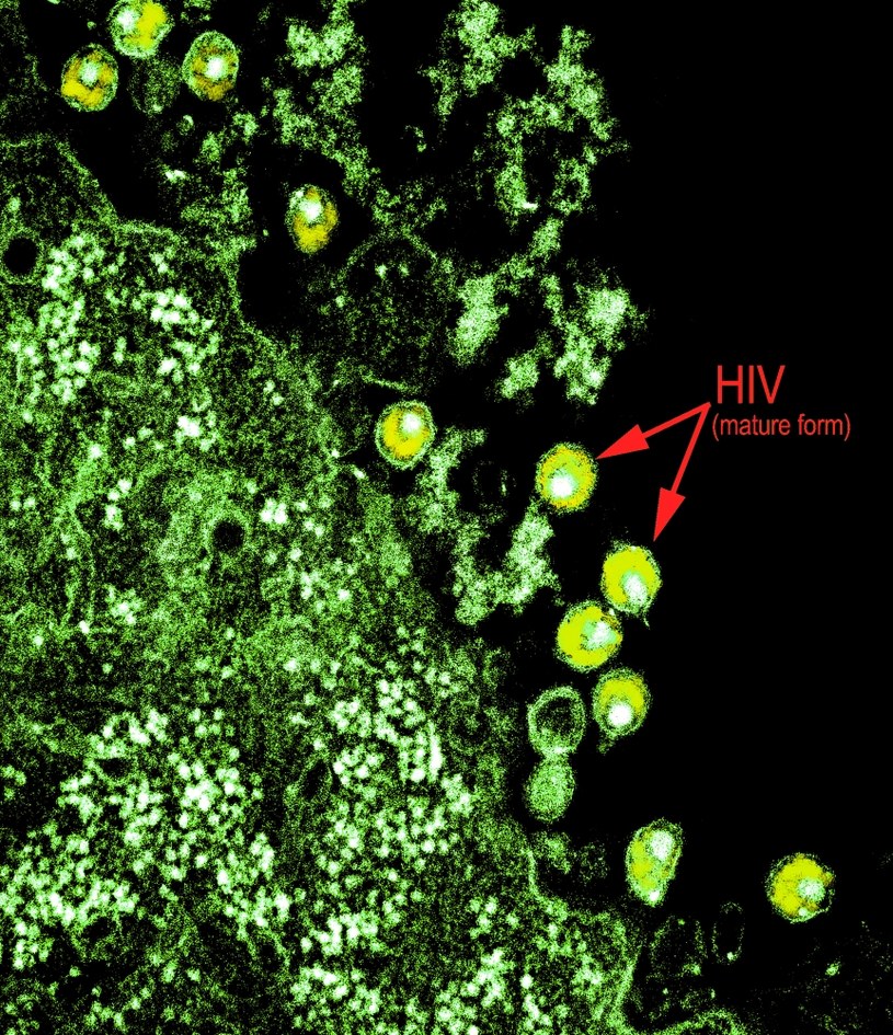 Wirus HIV-1 widziany przez transmisyjny mikroskop elektronowy (TEM) /Fot. BSIP/UIG Via Getty Images /Getty Images