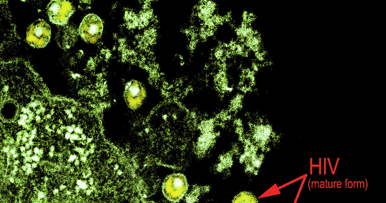 Wirus HIV-1 widziany przez transmisyjny mikroskop elektronowy (TEM) /Fot. BSIP/UIG Via Getty Images /Getty Images