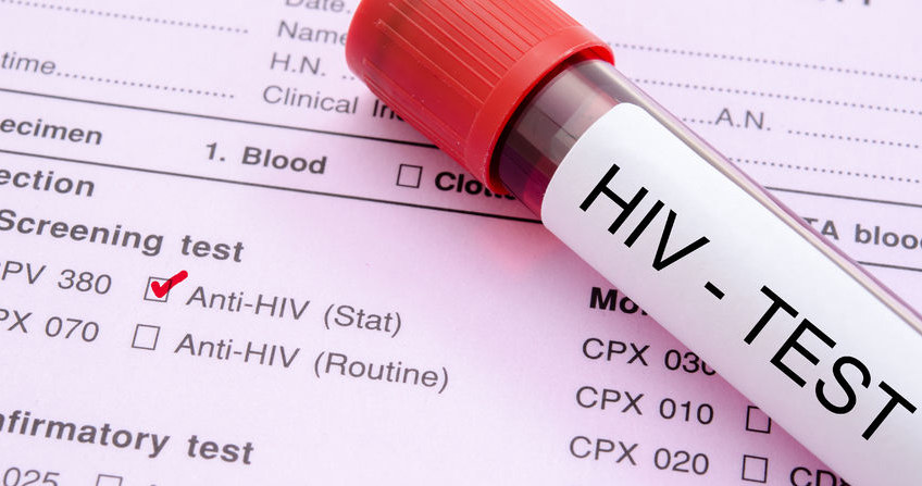 Wirus HIV groźniejszy niż SARS-CoV-2 /123RF/PICSEL