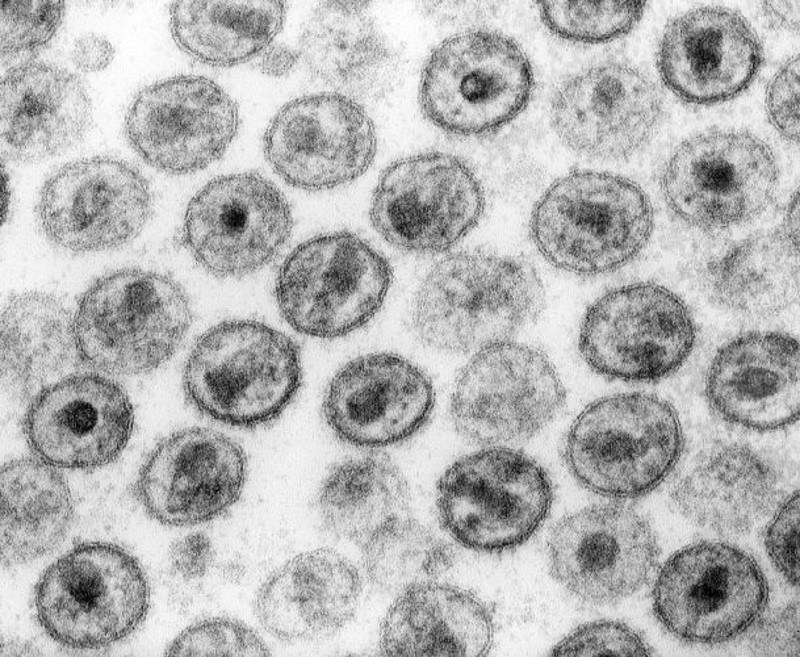 Wirus HIV pod mikroskopem /Wikimedia Commons /domena publiczna