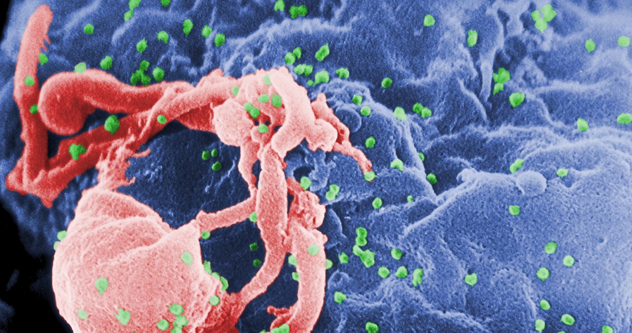 Wirus HIV /materiały prasowe