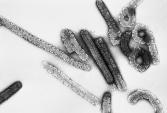 wirus Marburga /CDC/Dr. Erskine Palmer, Russell Regnery, Ph.D. /domena publiczna