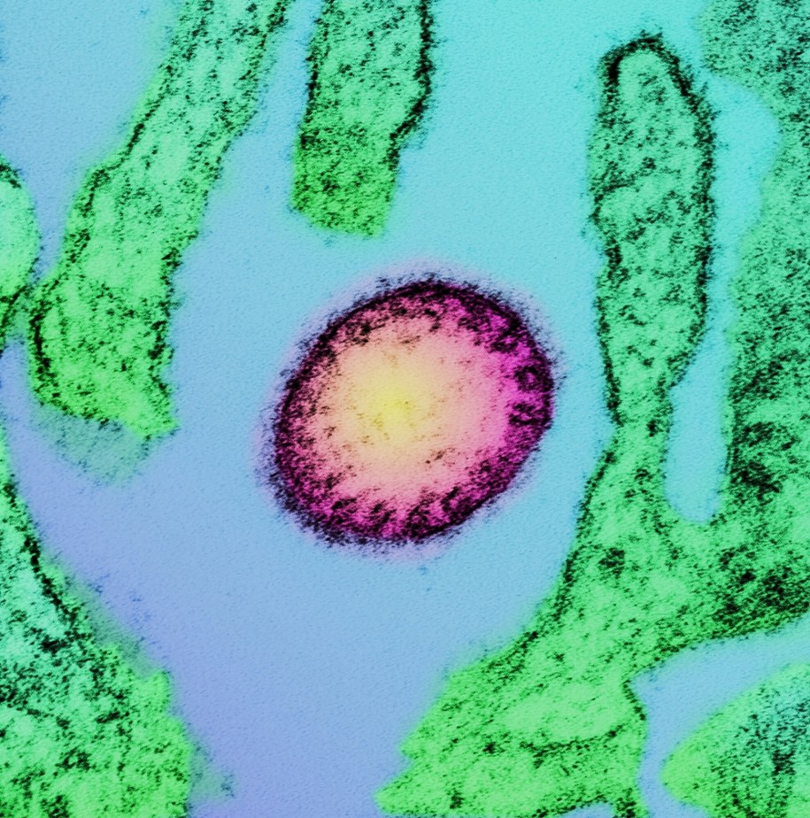 Wirus Nipah pozostaje poważnym zagrożeniem dla zdrowia publicznego /NATIONAL INSTITUTES OF HEALTH/Science Photo Library /East News