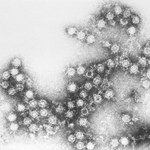 Wirus odpowiedzialny za przeziębienie zabija nowotwory