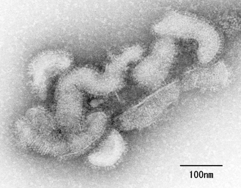 Wirus oz pod mikroskopem elektronowym /NATIONAL INSTITUTE OF INFECTIOUS DISEASES /PAP/EPA