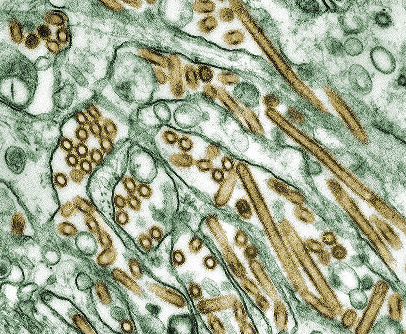 Wirus ptasiej grypy widoczny pod mikroskopem /Wikimedia Commons /domena publiczna