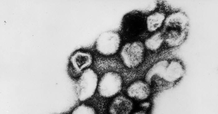 Wirus różyczki /Wikipedia