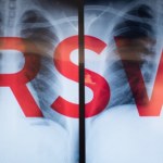 Wirus RSV atakuje! Oto, jak rozpoznać groźną infekcję i skutecznie się bronić