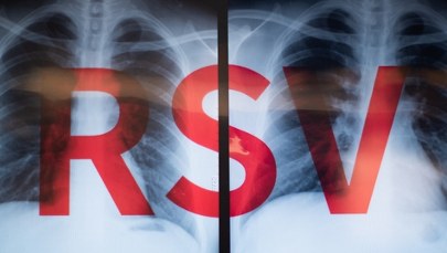 Wirus RSV atakuje! Oto, jak rozpoznać groźną infekcję i skutecznie się bronić