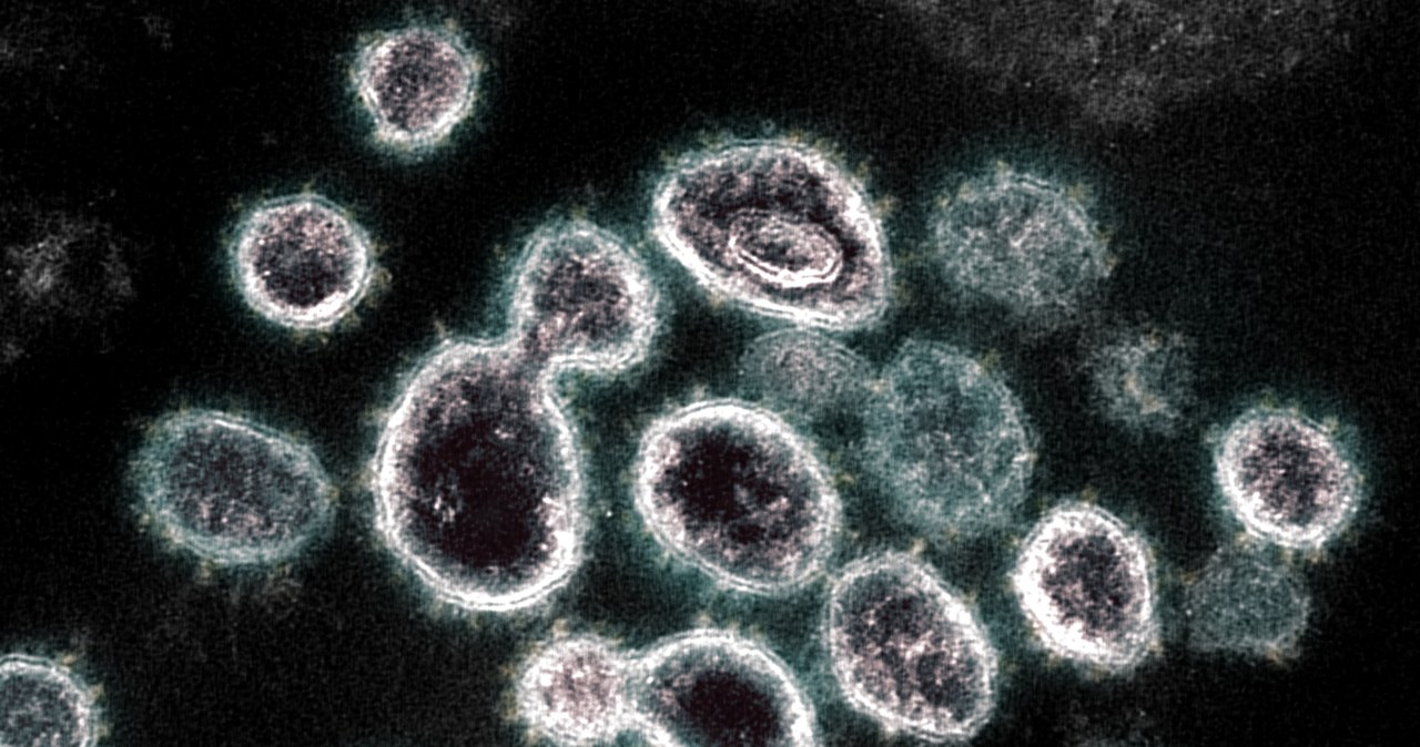 Wirus SARS-CoV-2 pod mikroskopem elektronowym /Getty Images