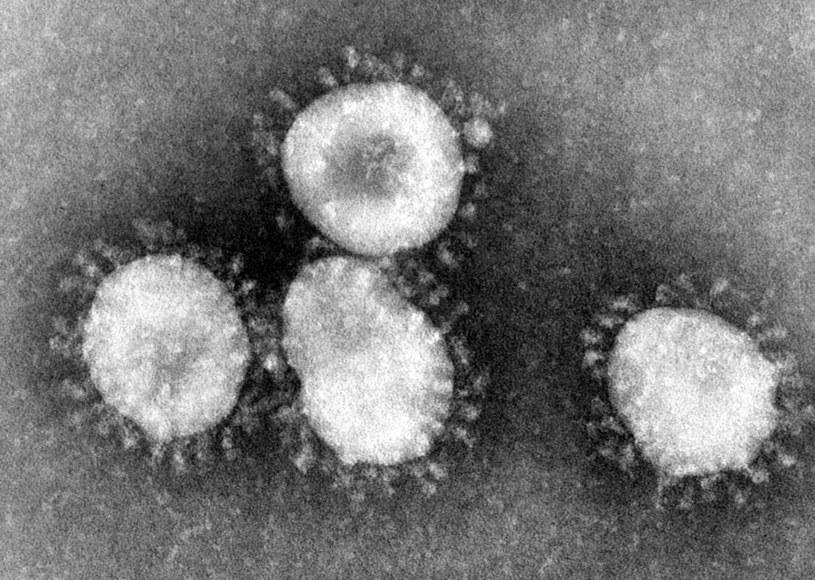 Wirus SARS, czyli ciężki ostry zespół oddechowy. Śmiertelność wynosi blisko 9 proc. /Wikimedia