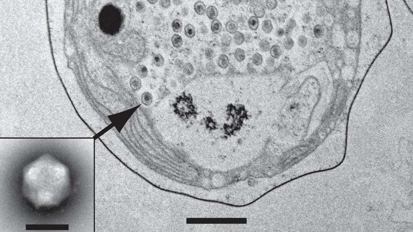 Wirus TetV-1 replikujący wewnątrz komórki glona /Fot. Christopher Schwarcz, UH Manoa /materiały prasowe
