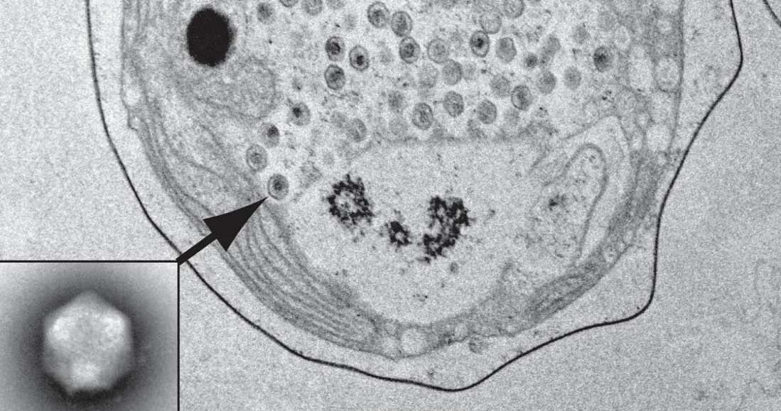 Wirus TetV-1 replikujący wewnątrz komórki glona /Fot. Christopher Schwarcz, UH Manoa /materiały prasowe