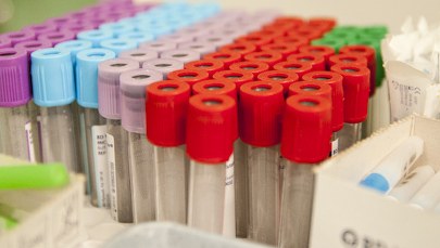 Wirus Zika może powodować ciężkie schorzenie neurologiczne