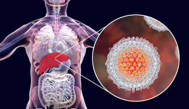 Wirusowe zapalenie wątroby typu C. Zakażenie HCV to "cichy zabójca"