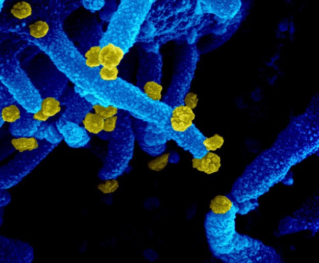 Wirusy SARS-Cov-2 pobrane od pacjentki z Kirkland i hodowane w kulturze komórek VERO-E6. Obraz ze skaningowego mikroskopu elektronowego /NIAID-RML /Materiały prasowe