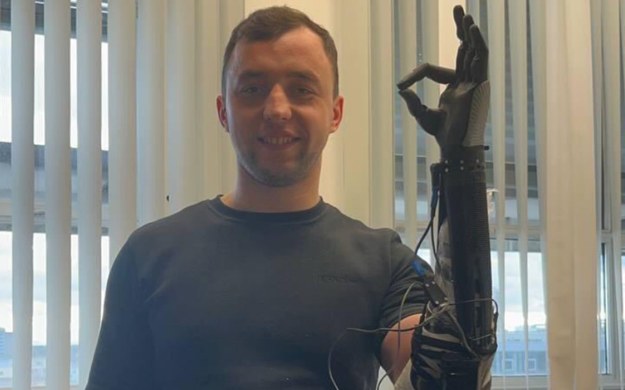 Witalij Iwaszczuk z bioniczną protezą ręki (Fot. Twitter/@superhumans_com) /