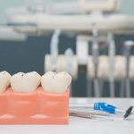 Wizyta prywatna u dentysty. Z jakimi kosztami trzeba się liczyć? Kolejna fala podwyżek za nami
