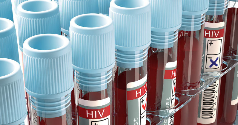 Wkrótce wirus HIV będzie uleczalny? /123RF/PICSEL