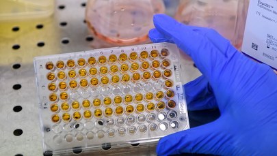 Władze województwa opolskiego proszą ministra zdrowia o aparat do wykrywania koronawirusa