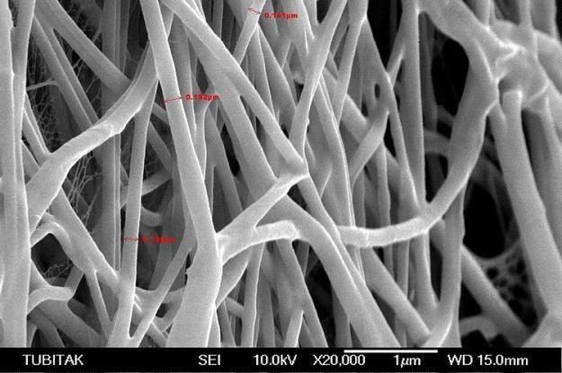 Włókna czuciowe - zdjęcie wykonane przy pomocy mikroskopu /materiały prasowe