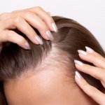 Włos się jeży - problemy na głowie