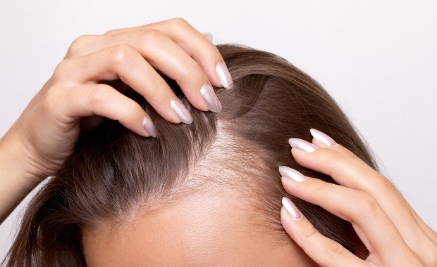 Włos się jeży - problemy na głowie