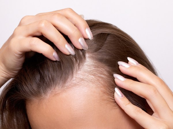 Włos się jeży - problemy na głowie