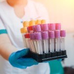 Wpływ wysiłku na wyniki badań laboratoryjnych. Czy trening zmienia poziom glukozy i hormonów? 