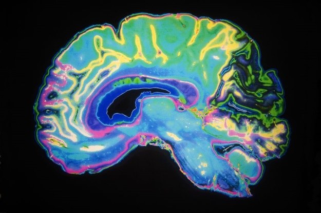 Wreszcie opracowano skuteczny test wykrywający chorobę Alzheimera? /123RF/PICSEL