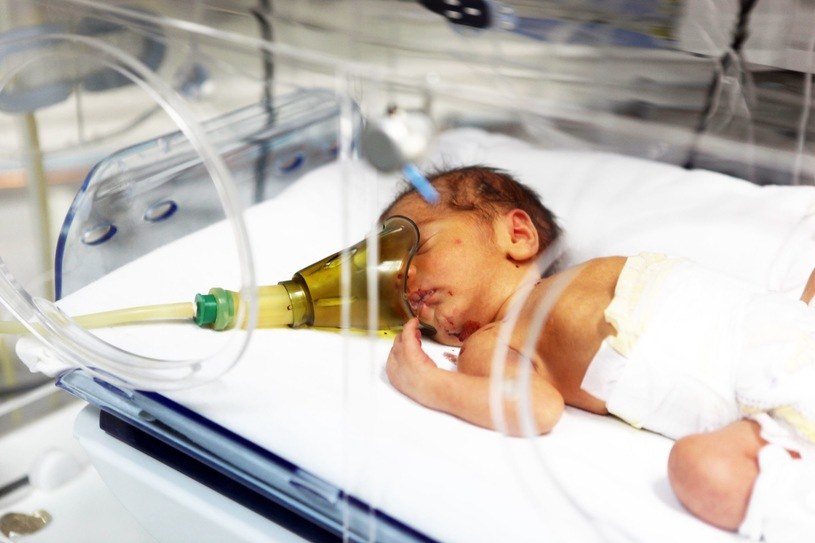 Współczesna medycyna ratuje noworodki, które wcześniej nie miały szans na przeżycie /123RF/PICSEL