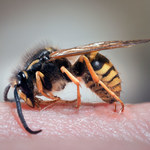 Wstrząs anafilaktyczny po ukąszeniu owada: Objawy i pierwsza pomoc