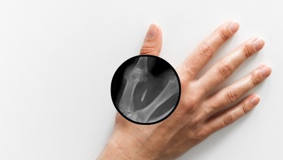 Wszczepił sobie pięć mikroczipów. Płaci dłonią, otwiera nią drzwi i bramki kontrolne