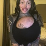 Wybuchł jej implant piersi ważący... 10 kg! Teraz żałuje: "Moje ciało nie dało rady!