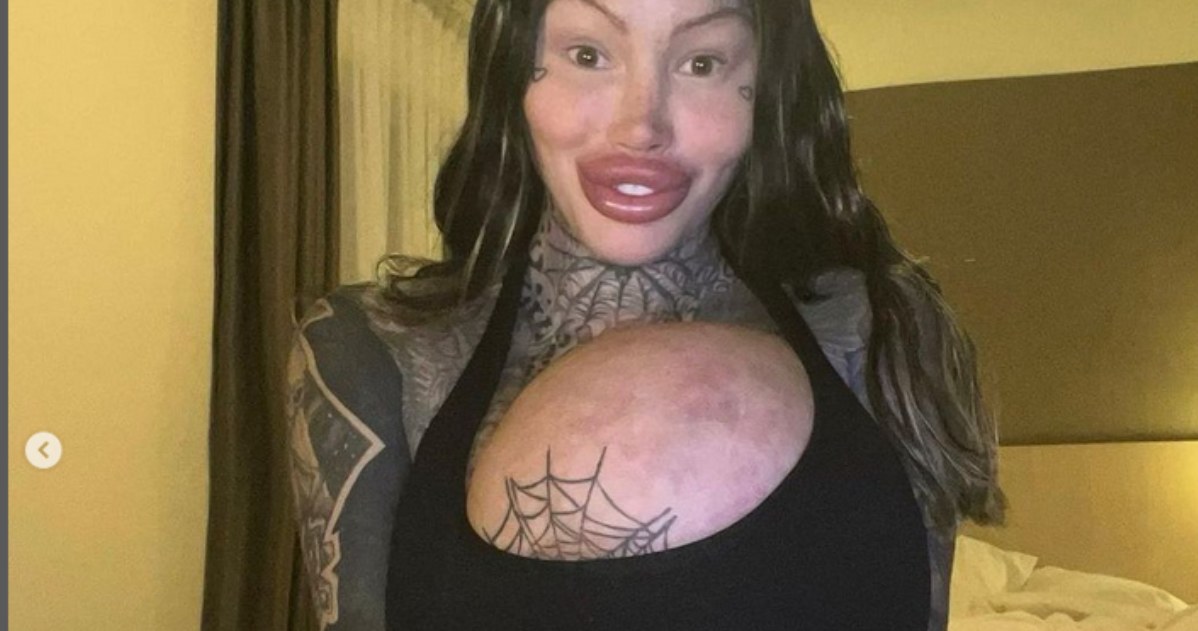 Wybuchł jej implant piersi ważący... 10 kg! Teraz żałuje: "Moje ciało nie dało rady! /Instagram