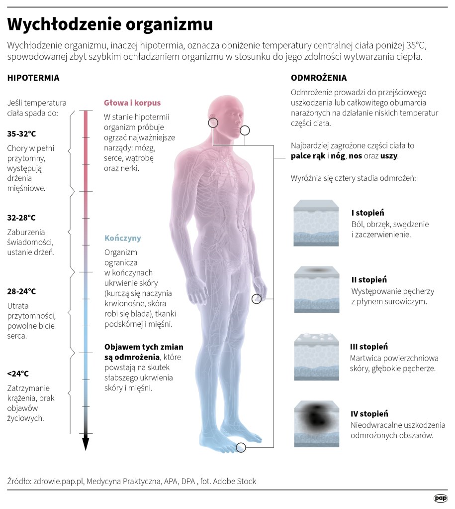 Wychłodzenie organizmu /Mateusz Krymski /PAP