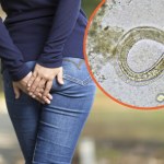 Wychodzą z ciała nocą. Po tym rozpoznasz, że masz robaki