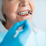 Wydają kilkaset złotych u dentysty prywatnie, a na NFZ jest za darmo. Mało kto o tym wie