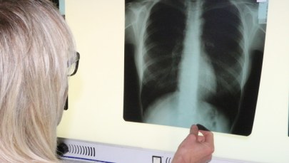 Wydawało się, że te choroby już nie powrócą. Teraz atakują ze zdwojoną siłą