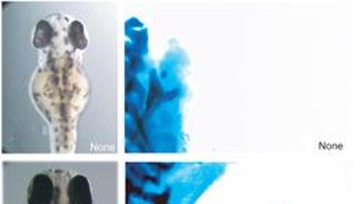 Wyjaśniona zagadka talidomidu