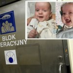 operacja Wyjątkowa operacja bliźniaków. Ignaś i Wiktorek wracają do zdrowia