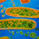 Wyjątkowy szkielet z Edynburga. "DNA czarnej śmierci sprzed 700 lat"