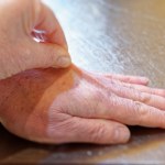 Wykonaj prosty test. Tak sprawdzisz, czy organizm jest odwodniony