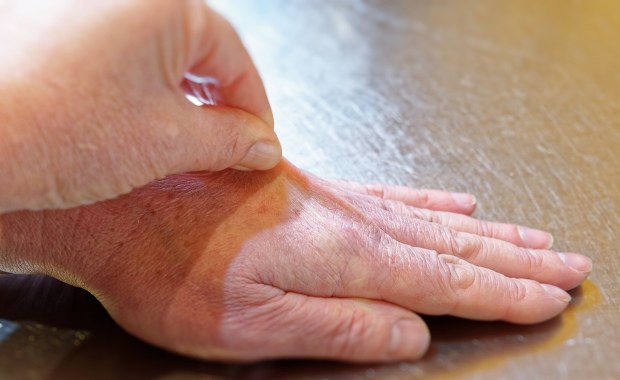 Wykonaj prosty test. Tak sprawdzisz, czy organizm jest odwodniony