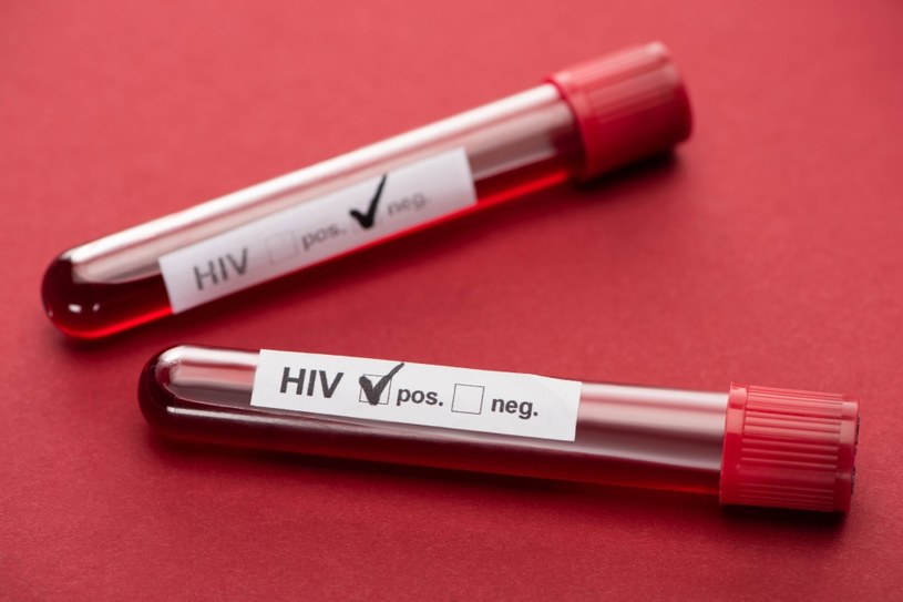 Wykonanie badania na obecność przeciwciał anty-HIV jest konieczne, by zdiagnozować zakażenie /123RF/PICSEL