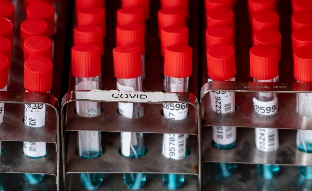 Wykonano pierwszą fotografię nowego wariantu Omikron 